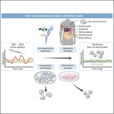 Stem Cell-Derived Islets To Treat Diabetes | Endocrine Society